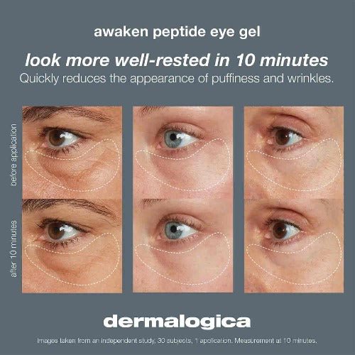 Dermalogica Awaken Peptide Eye Gel 15 ml - Emerald Beauty & Spa